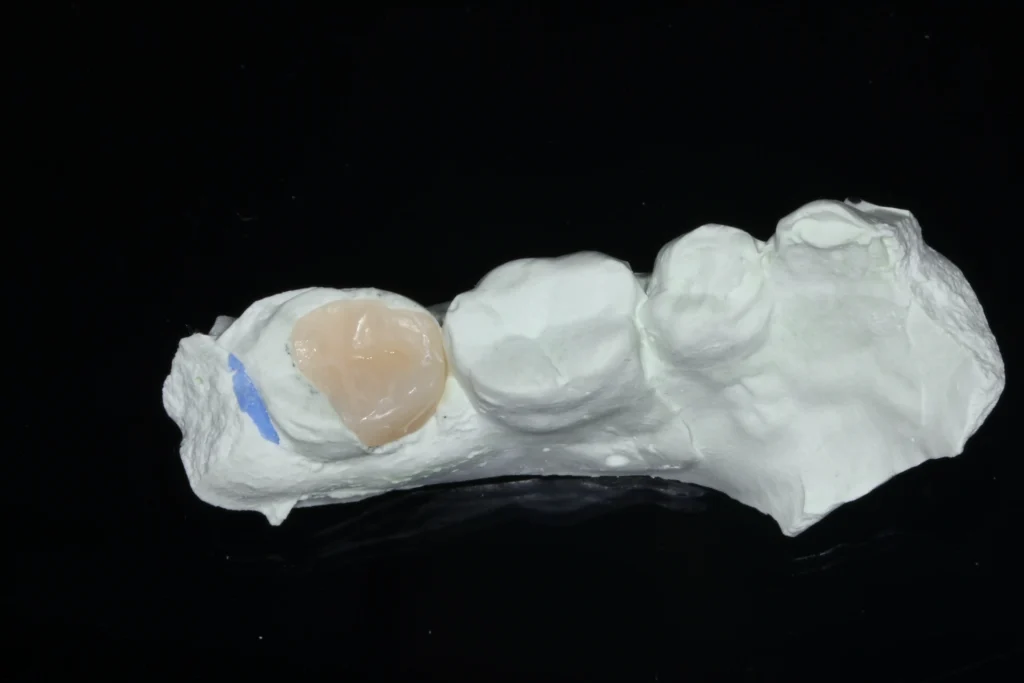 Biomimetic Dentistry vs Conventional Restorative Dentistry