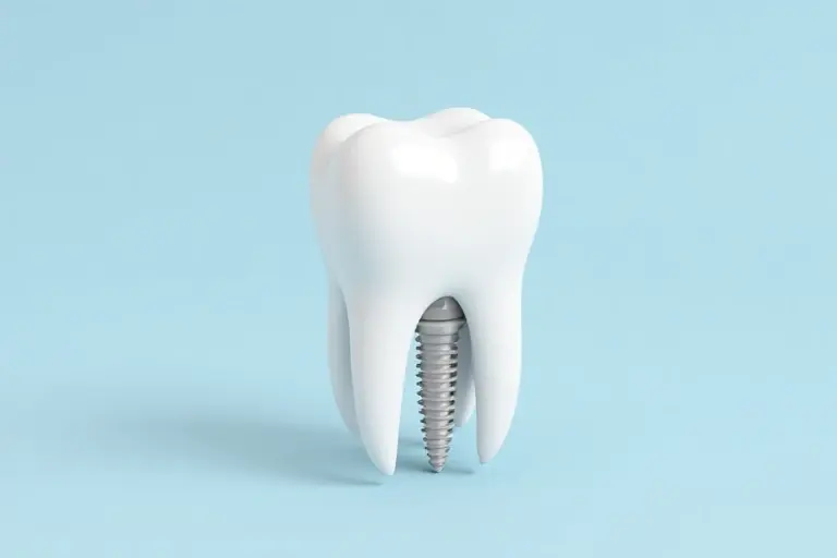 Dental Implant Cost in Malaysia What You Need to Know Before You Decide