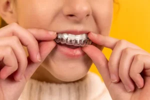 how much do braces cost in Malaysia